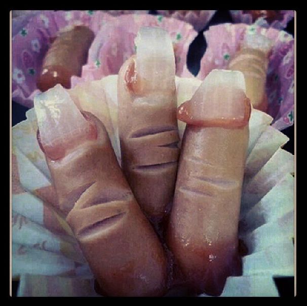 Sausage-fingers
