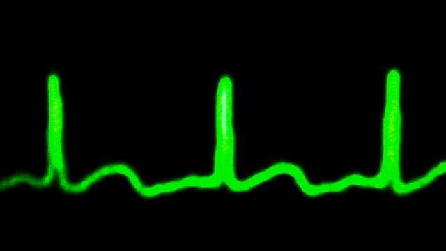 heartbeat-pulse