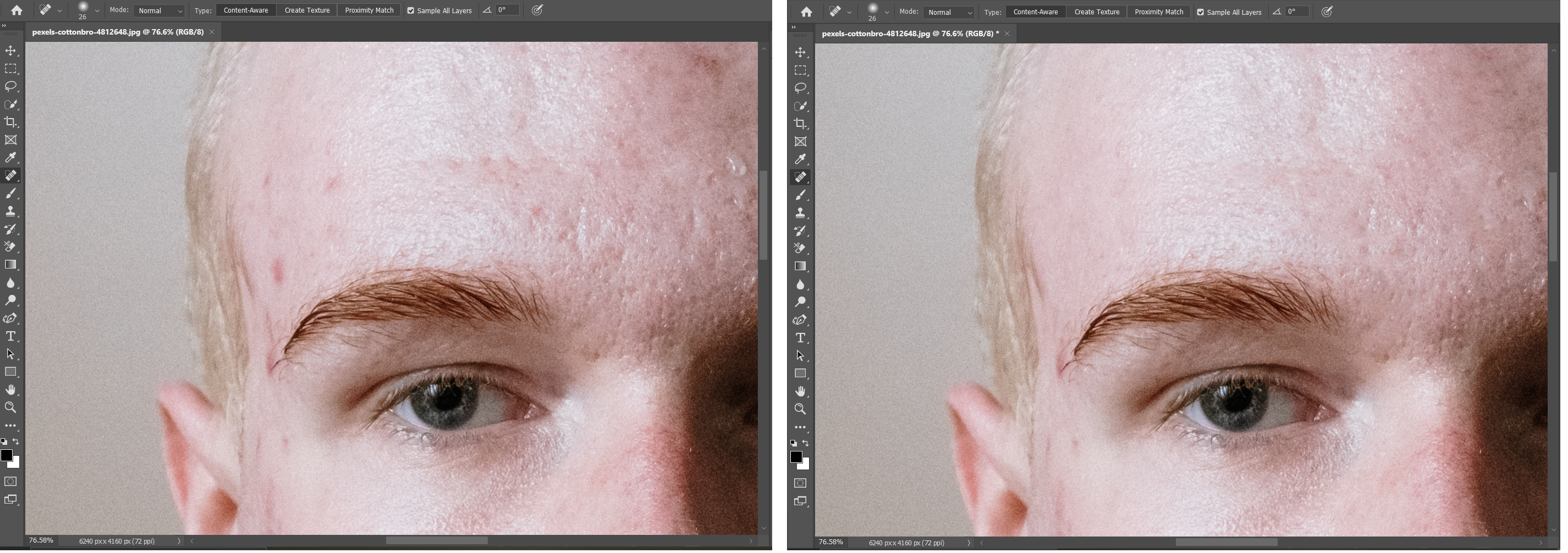 Photoshop screens of a man with and without spots