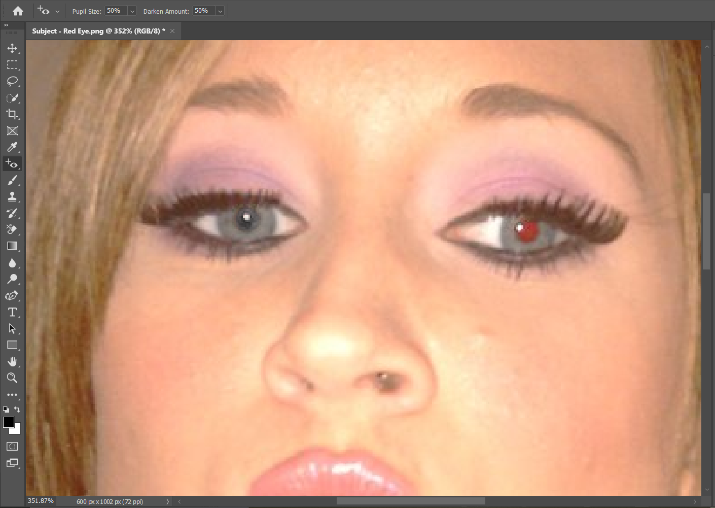 A woman with one red eye, one eye fixed in Photoshop