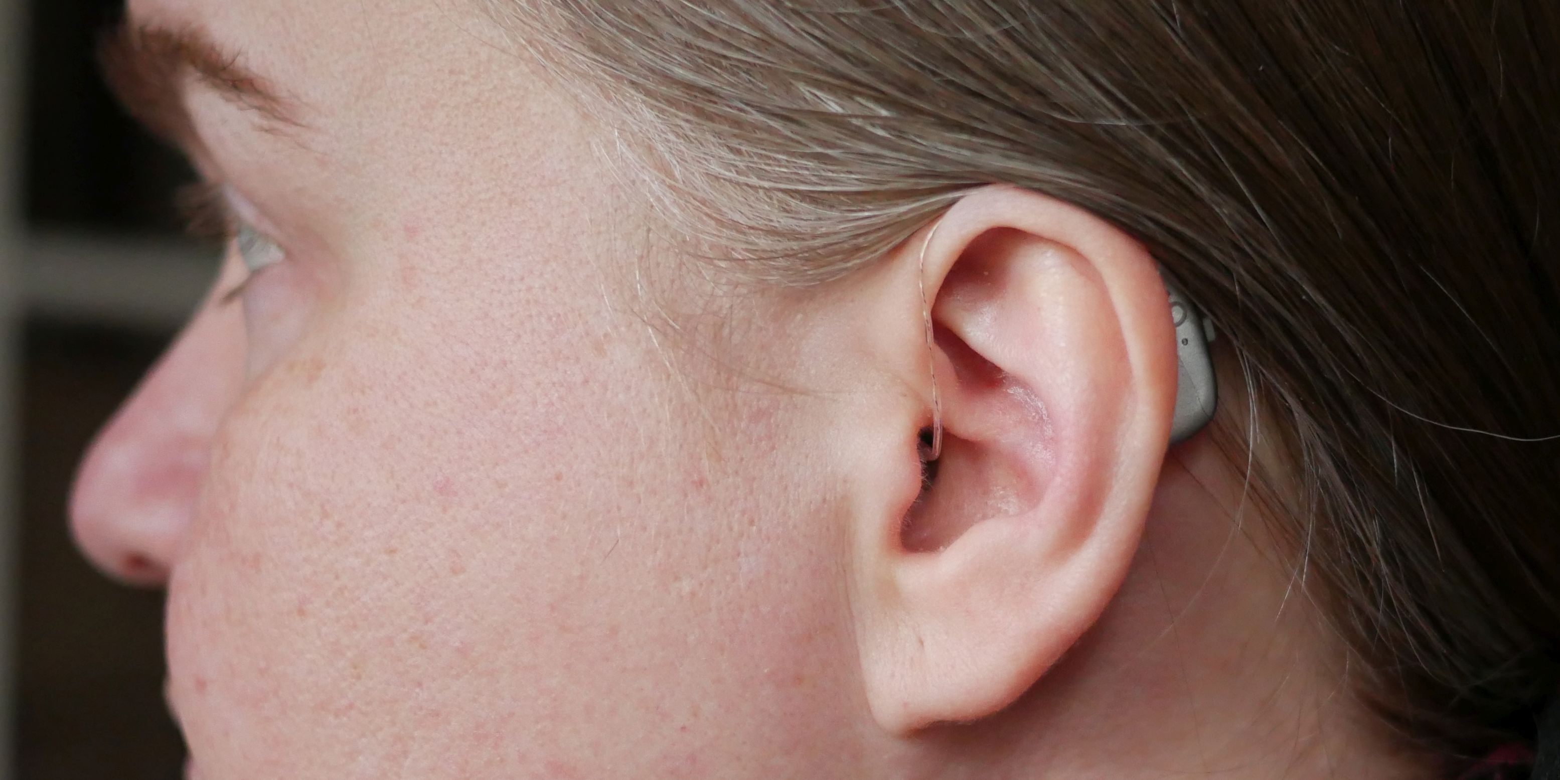 Widex MOMENT almost invisible behind-the-ear hearing aids