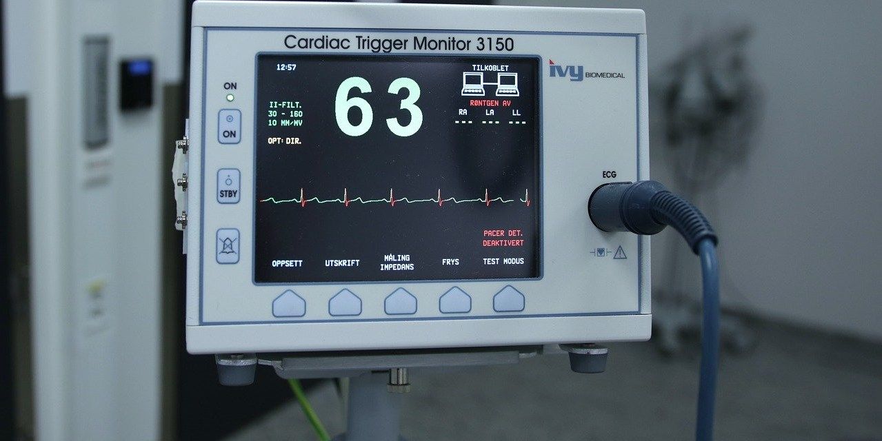 Cardiac trigger monitoring device