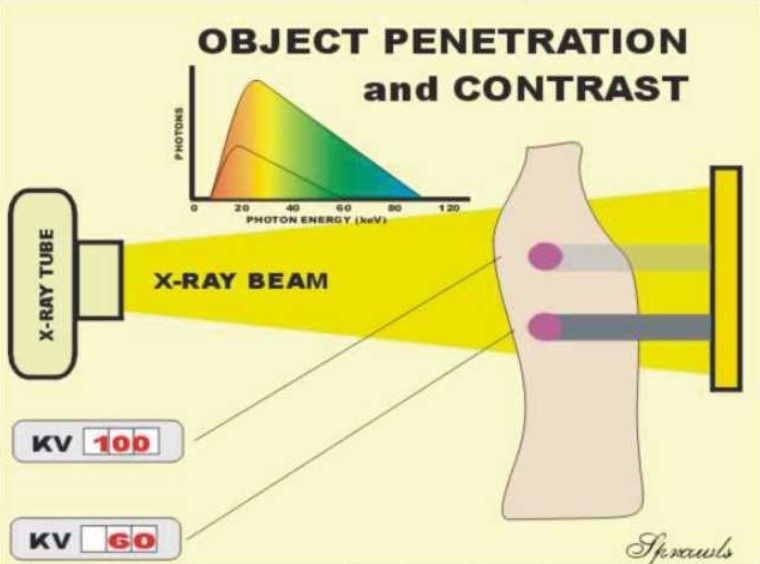 how-x-rays-work-2