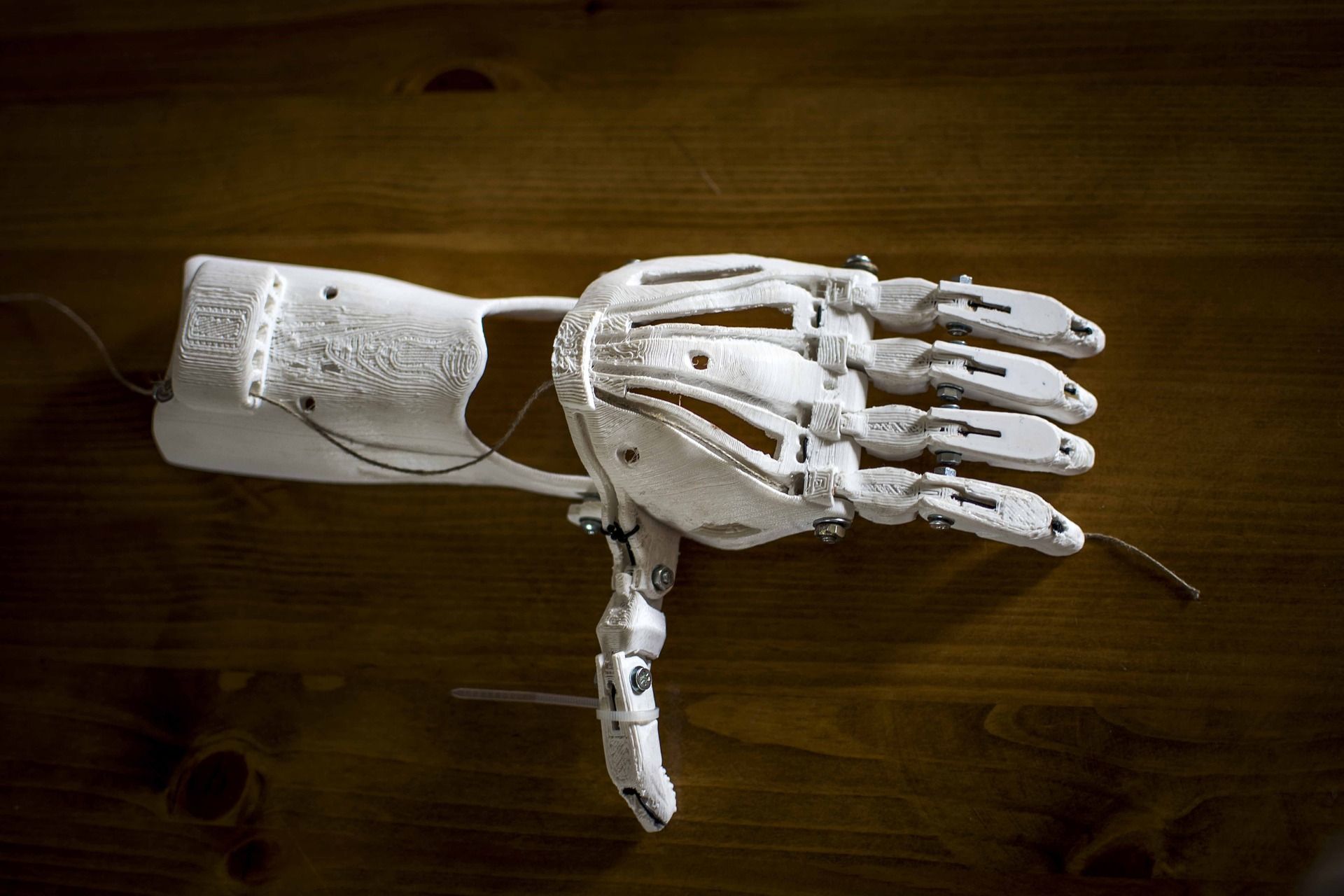 3D Printed Prosthetic Forearm and Hand in White