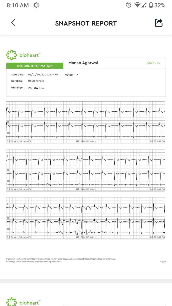 Exporting heart rhythm snapshot in Bioheart