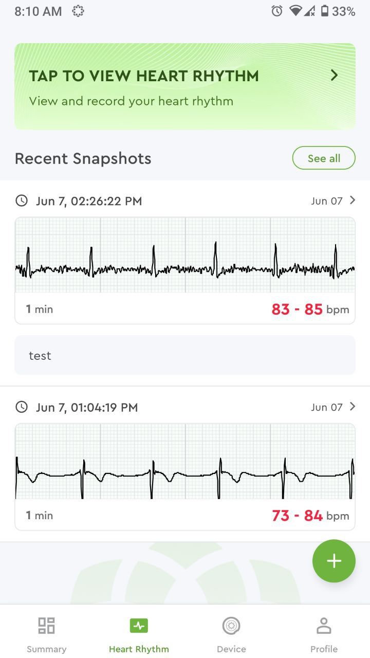 Viewing heart rhythm in Bioheart app