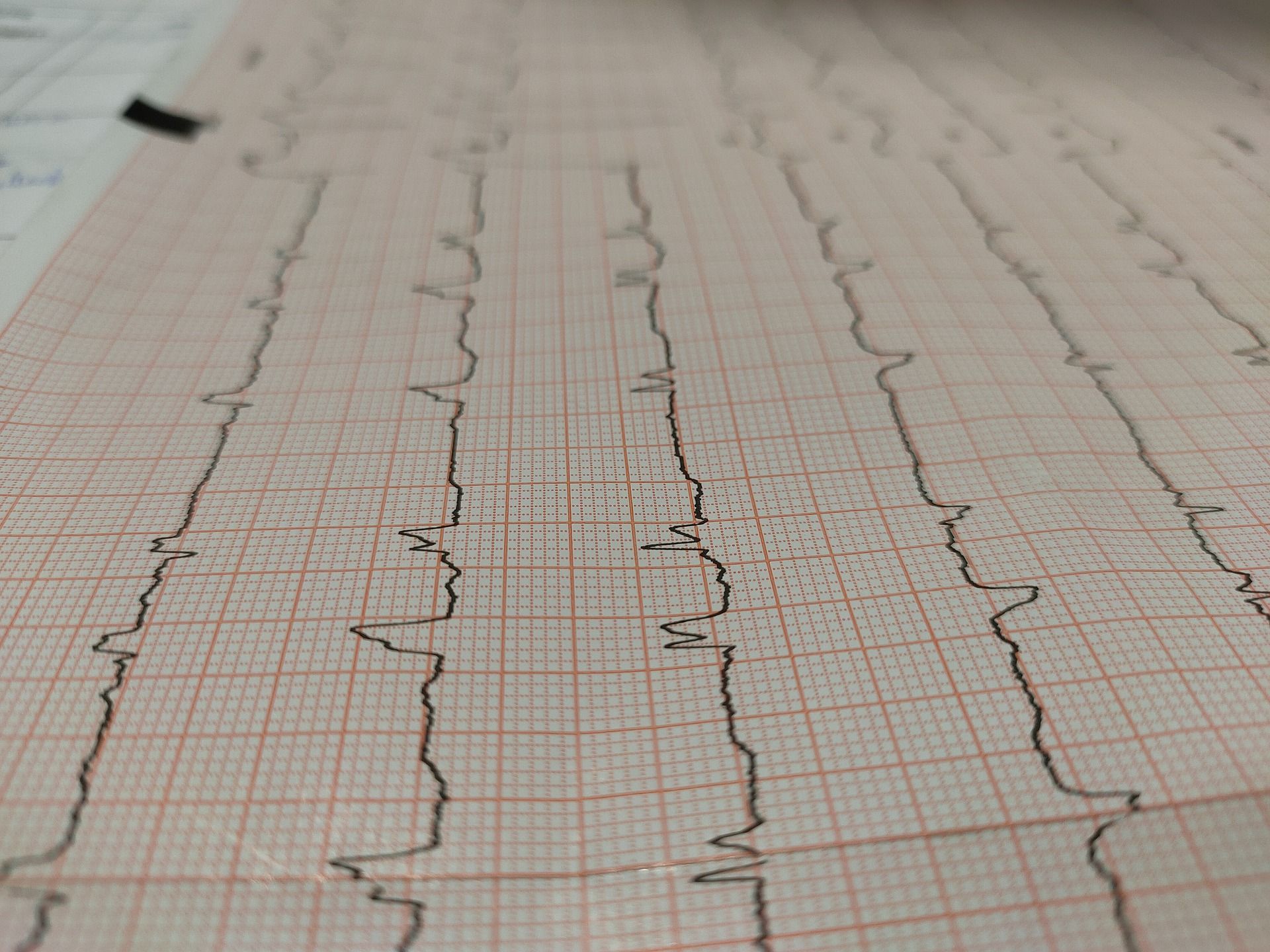 An electrocardiogram reading on a piece of paper