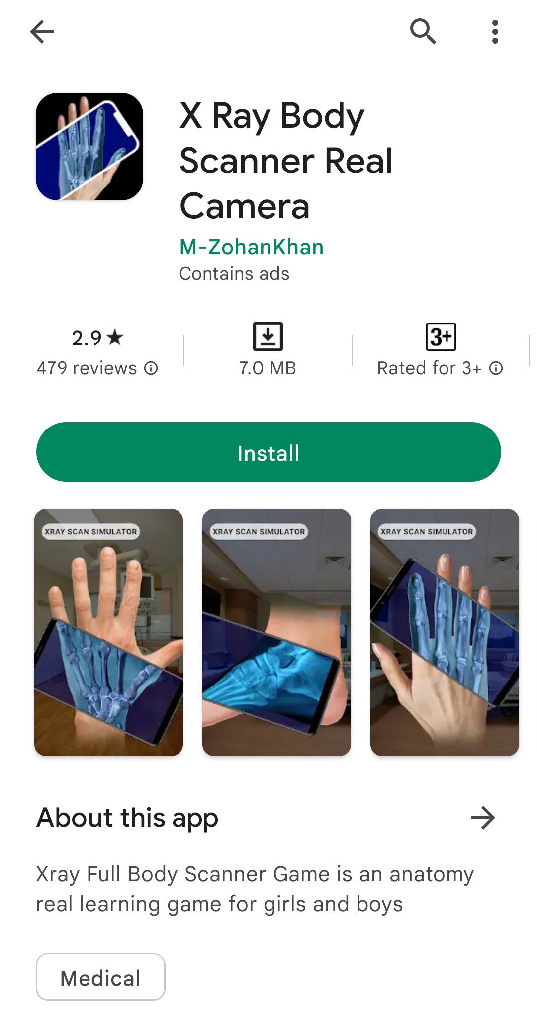description of a fake android x-ray app